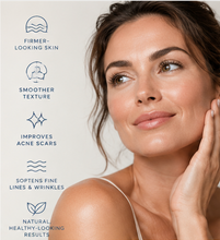 Load image into Gallery viewer, SkinPen Microneedling - 20% Off