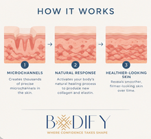 Load image into Gallery viewer, SkinPen Microneedling - 20% Off
