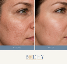 Load image into Gallery viewer, SkinPen Microneedling - 20% Off